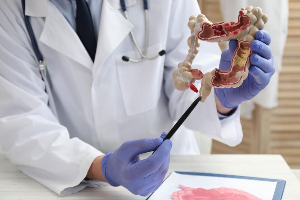 Colonoscopia en CDMX: diagnóstico y evaluación integral del intestino grueso